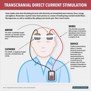 تاثیر tDCS بر اضطراب