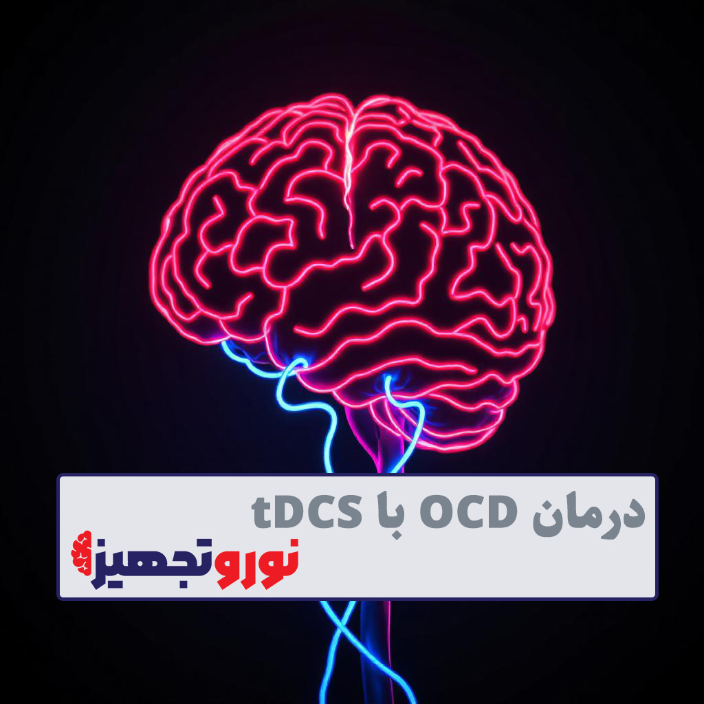 درمان OCD با tDCS ( درمان وسواس با تحریک الکتریکی مغز ) - نوروتجهیز