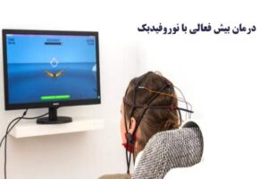 درمان بیش فعالی (ADHD) با نوروفیدبک