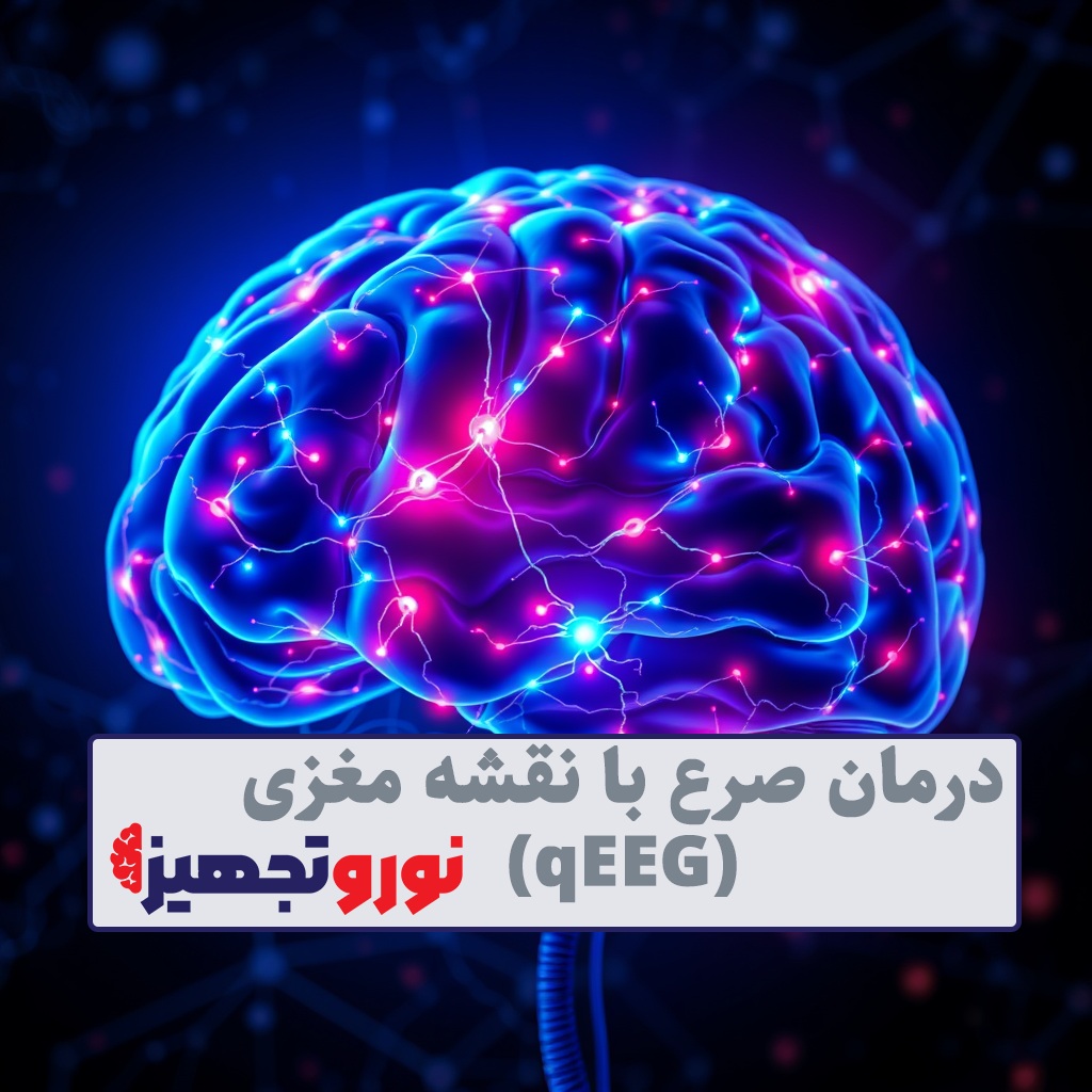 درمان صرع با نقشه مغزی (qEEG) | تشخیص صرع با qeeg ) نقشه مغزی ) - نوروتجهیز