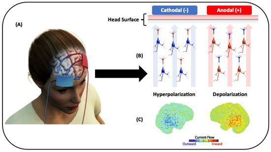 موارد منع استفاده از tDCS