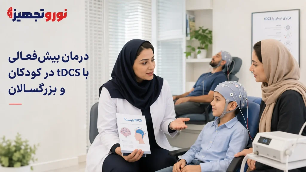 درمان بیش فعالی با tDCS